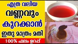 How to Loss Belly Fat  വണ്ണം കുറക്കാൻ ഇനി ഇത് മതി [upl. by Yalonda911]