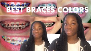 BEST BRACES COLOR TO GET [upl. by Ahsekel201]