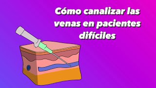 4 consejos para canalización canulación venosa difícil [upl. by Ahtamat]