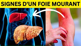 Signes avantcoureurs de problèmes hépatiques  Comment prendre soin de votre foie  Guide complet [upl. by Ahsinotna846]