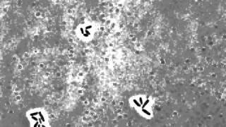 Cell growth and cell division in the rodshaped actinomycete Corynebacterium glutamicum [upl. by Uos]