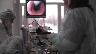 Selfexpanding Nitinol Stent placement under endoscopy control [upl. by Adniralc178]