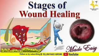 Stages of WOUND HEALING  NURSING  Made Easy [upl. by Ettena]