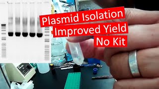 Plasmid DNA Isolation  Improved Yield No Kit [upl. by Lillis900]