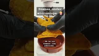 Snacks🍿 under microscope 🔬 Shocking 😳 results 💯 science lab laboratory scienceclass foryou [upl. by Nanda]