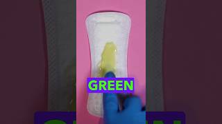 Why Is My Vaginal Discharge Yellow Or Green womenshealth patienteducation [upl. by Robina]