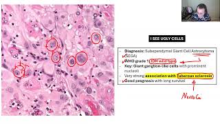 NEUROPATHOLOGY BOARD REVIEW 2 [upl. by Moss408]