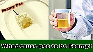 Frothy Urine – What cause pee to be Foamy [upl. by Murtagh]