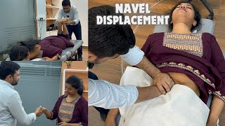 Dr Harish Grover Reveals Navel Displacement Cure [upl. by Ambrosine241]