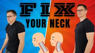 Decompress Your NECK  Self Traction Your Neck For Pain Relief  Dr Jon Saunders [upl. by Tnomad]