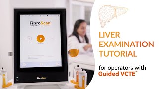 Tutorial liver examination with FibroScan® and Guided VCTE™ [upl. by Syxela]