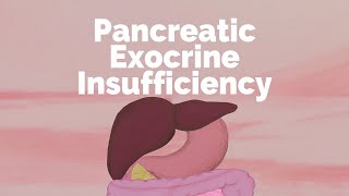 Pancreatic Exocrine Insufficiency  Gastrointestinal Society [upl. by Moises559]