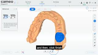 6 CAMEO elegant Ⅲ Inlay scanning guidance video [upl. by Iglesias]