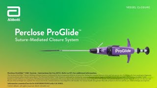 US Small Hole ProGlide™ Deployment Video [upl. by Amlas]