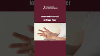 Causes and Treatments for Trigger Finger 👍 TriggerFinger HandPain ChronicPain PainRelief [upl. by Satterfield]