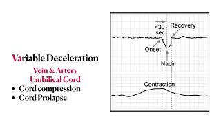 Fetal heart rate tracing  Mnemonics Concepts amp Management  High yield review [upl. by Patrica]