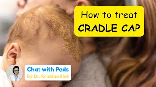 How to treat Cradle Cap in Babies  Seborrheic Dermatitis  Chat with Peds by Dr Kristine Kiat [upl. by Eldnek]