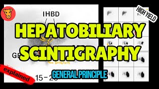 Hebatobiliary Scintigraphy Explained HIDA scan [upl. by Butcher]