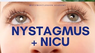 Nystagmus and NICU  What Causes Nystagmus [upl. by Nylcoj]