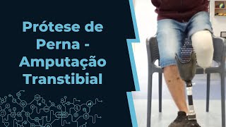 Prótese de Perna  Amputação Transtibial  Cristopher [upl. by Nirad263]