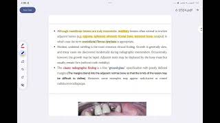 oral pathology lec 6 fibro osseous lesion [upl. by Drud179]