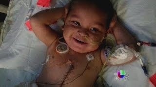 Un niño se recupera de un trasplante de cinco órganos en Miami  Noticiero Univisión [upl. by Nosyk]