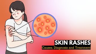 Skin Rash Causes Signs and Symptoms Diagnosis and Treatment [upl. by Marielle944]