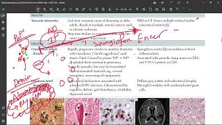 49 Creutzfeldt Jakob Diseases [upl. by Ojimmas430]