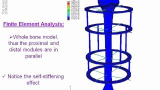 Finite Element Analysis of Ilizarov External Fixator [upl. by Nisse324]