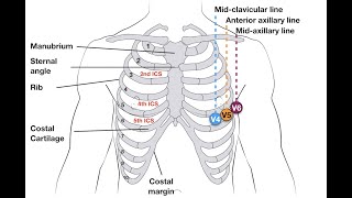 Placement of Electrodes For Electrocardiography 12 lead placement [upl. by Hope]