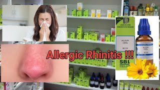 What is Allergic Rhinitis Homeopathic Medicine for Allergic Rhinitis  Health qo [upl. by Madox]