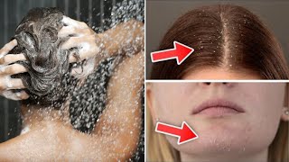 8 erreurs surprenantes sous la douche qui nuisent a votre peau [upl. by Thinia]