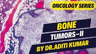 BONE TUMORS2 BY DRADITI KUMAR [upl. by Hayila]