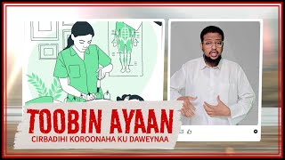 TOOBIN AYAAN CIRBADIHI KOROONAHA KU DAWEYNAA [upl. by Quintina]