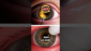 El PRIMER TRASPLANTE OCULAR una HAZAÑA MÉDICA curiosidades sabiasque TrasplanteDeOjo [upl. by Vardon]