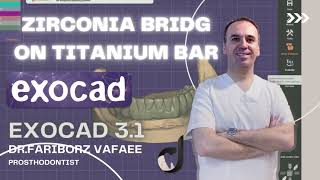 How to design zirconia bridge on titanuom bar in exocad31 [upl. by Dera]