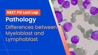 Pathology  Differences between Myeloblast and Lymphoblast [upl. by Tien270]