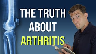 5 Things Your Doctor Never Told You About Arthritis [upl. by Etnwahs]