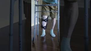 Syamantak’s Electronic Knee Brace Enhances Mobility for Individuals with Disabilities [upl. by Rhianon]