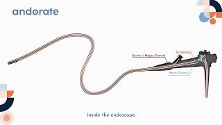 What might be missing in Endoscope Bedside Cleaning [upl. by Airdnala]