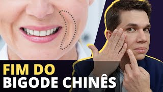 FIM DO BIGODE CHINÊS Como tratar e acabar DEFINITIVAMENTE com essa Ruga [upl. by Johny]