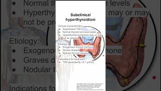 Subclinical hyperthyroidism [upl. by Waldner]