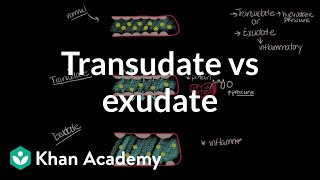 Transudate vs exudate  Respiratory system diseases  NCLEXRN  Khan Academy [upl. by Etaner713]