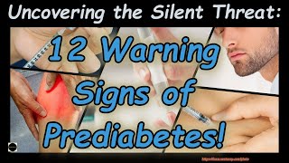 quotUncovering the Silent Threat 12 Warning Signs of Prediabetes [upl. by Clower9]