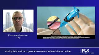 Closing TAVI with next generation suture mediated closure device  PCR London Valves 2021 [upl. by Ynahpets401]