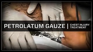 Treatment of Chest Injury with Petrolatum Gauze [upl. by Elleynad]