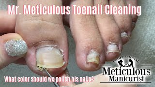 Mr Meticulous Satisfying Impacted Toenail Cleaning Holiday Specials Announcement [upl. by Harat]