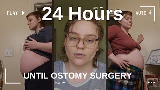 24 Hours Until Ostomy Surgery  Ostomy Countdown [upl. by Peirsen]