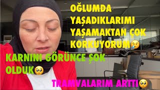 OĞLUMDA YAŞADIKLARIMI YAŞAMAKTAN ÇOK KORKUYORUM😢TRAVMALARIM ARTTI🥺KARNINI GÖRÜNCE ŞOK OLDUK🤲 [upl. by Moretta962]