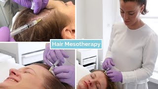 Hair Loss Mesotherapy  The Laser and Skin Clinic [upl. by Cordeelia]